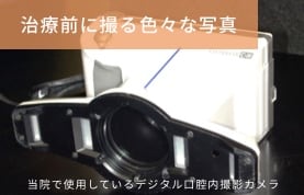 岡崎市 のじまデンタルクリニック 口腔内写真