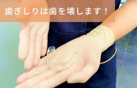 岡崎市 のじまデンタルクリニック 歯ぎしりは歯を破壊します！